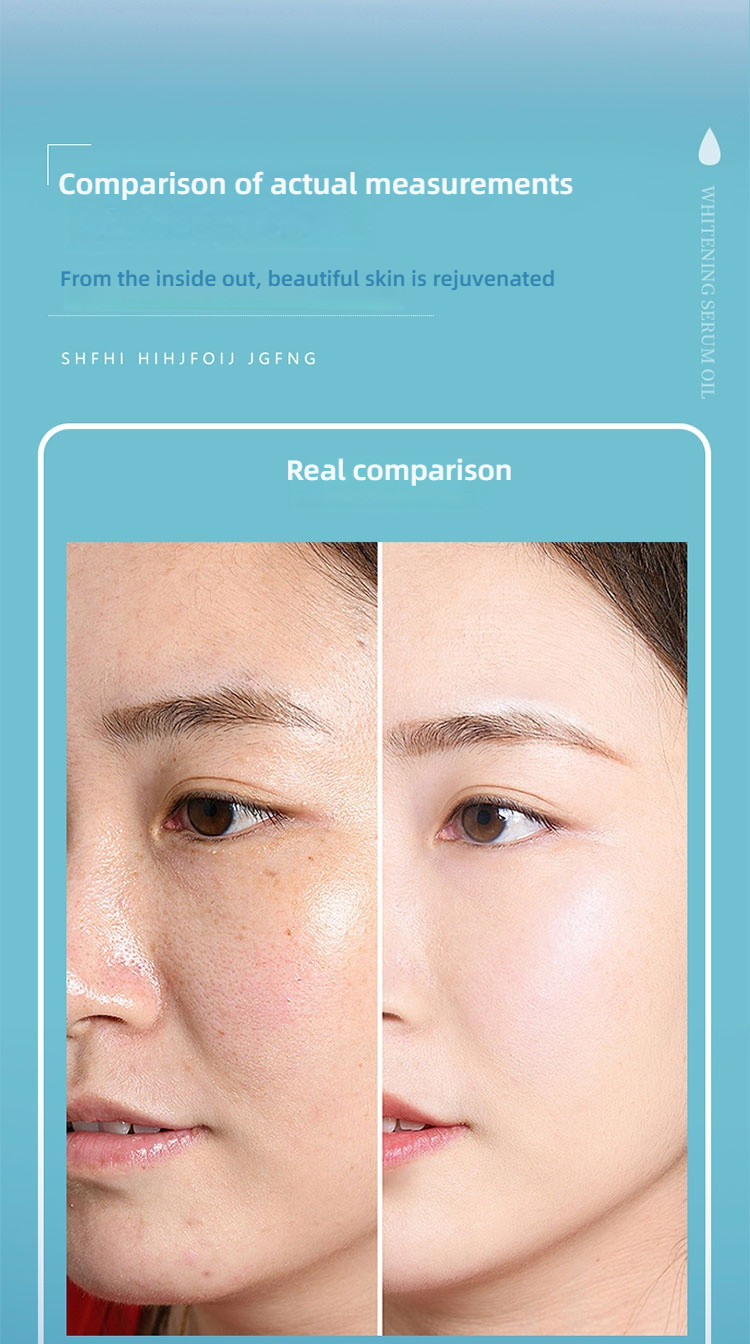 Interest 30ml Private Care Whitening Essence Oil